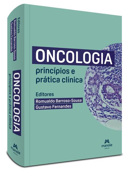 Imagem de Livro - Oncologia