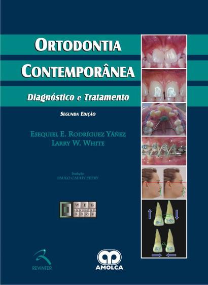 Imagem de Livro - Ortodontia Contemporânea