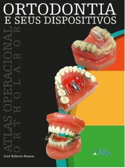 Imagem de Livro - Ortodontia e seus Dispositivos - Ramos - Tota