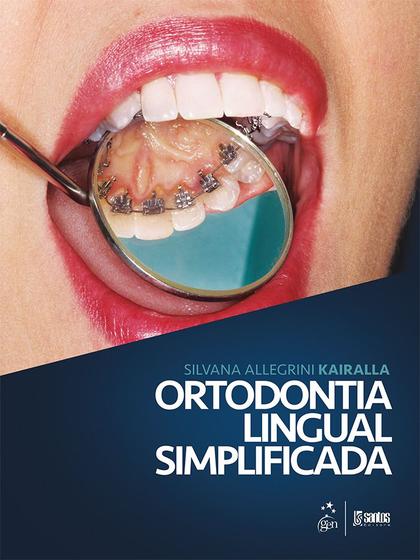 Imagem de Livro - Ortodontia Lingual Simplificada