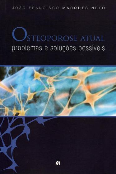 Imagem de Livro - Osteoporose Atual - Problemas e Soluções Possíveis - Marques Neto - Segmento Farma