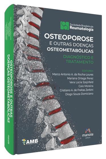 Imagem de Livro - Osteoporose e outras doenças osteometabólicas