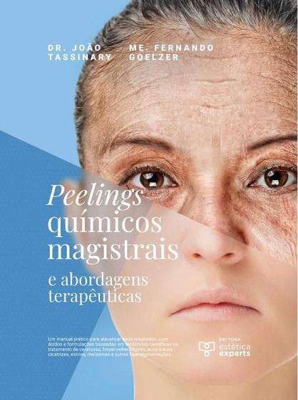 Imagem de Livro Peelings Químicos Magistrais E Abordagens Terapêuticas - Estética Experts