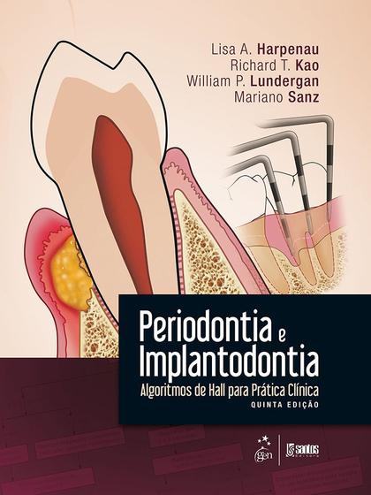 Imagem de Livro - Periodontia e Implantodontia - Algoritmos de Hall para Prática Clínica