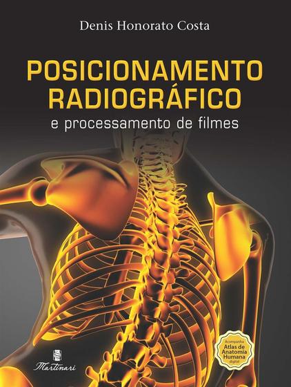 Imagem de Livro Posicionamento Radiográfico E Processamento De Filmes - Completo - Martinari