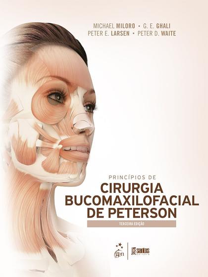 Imagem de Livro - Princípios de cirurgia bucomaxilofacial de peterson