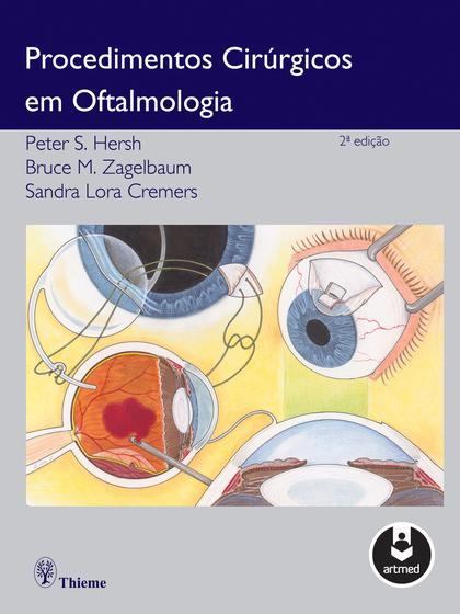 Imagem de Livro - Procedimentos Cirúrgicos em Oftalmologia