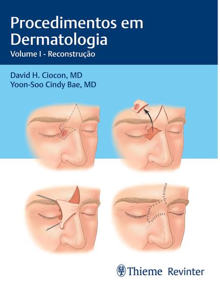 Imagem de Livro - Procedimentos em Dermatologia