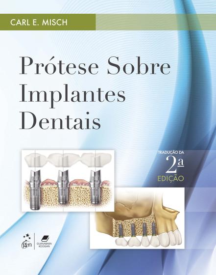 Imagem de Livro - Prótese sobre Implantes Dentais