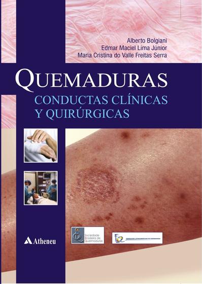 Imagem de Livro - Quemaduras - Conductas clinicas y quirurgicas