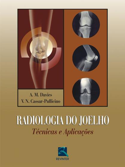 Imagem de Livro - Radiologia do Joelho