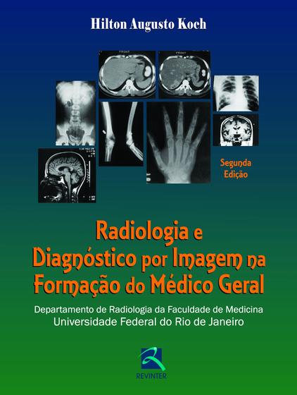 Livro - Radiologia e Diagnóstico por Imagem na Formação do Médico Geral Menor preço em Livro - Radiologia e Diagnóstico por Imagem na Formação do Médico Geral