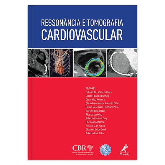 Imagem de Livro - Ressonância e tomografia cardiovascular