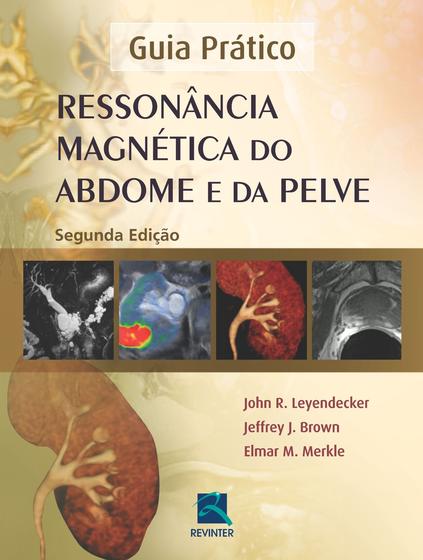 Imagem de Livro - Ressonância Magnética do Abdome e da Pelve