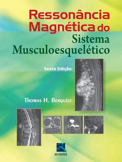 Imagem de Livro - Ressonância Magnética do Sistema Musculoesquéletico
