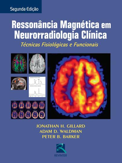 Imagem de Livro - Ressonância Magnética em Neurorradiológica Clínica
