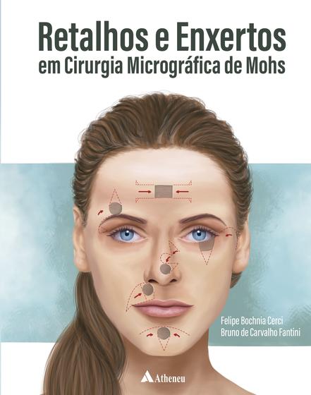 Imagem de Livro - Retalhos e Enxertos em Cirurgia Micrográfica de Mohs