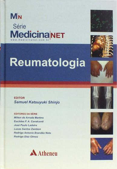 Imagem de Livro - Reumatologia
