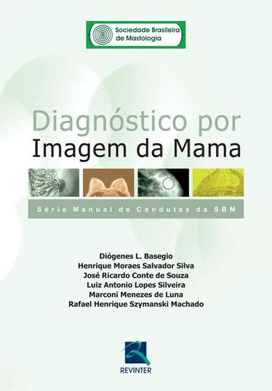 Imagem de Livro - SBM Diagnóstico por Imagem da Mama