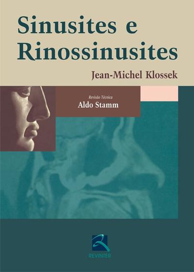 Imagem de Livro - Sinusites e Rinossinusites
