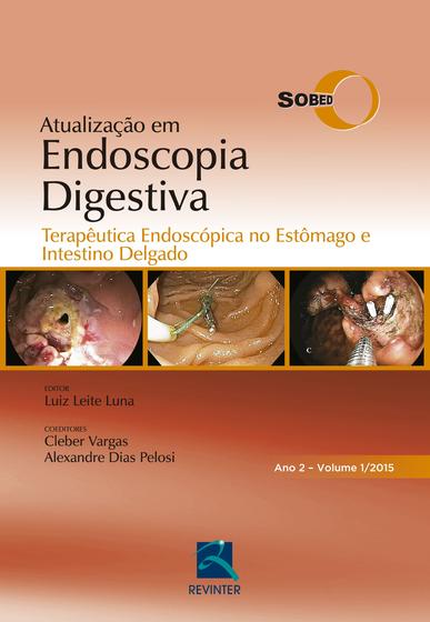 Imagem de Livro - SOBED Atualização em Endoscopia Digestiva - Volume 1