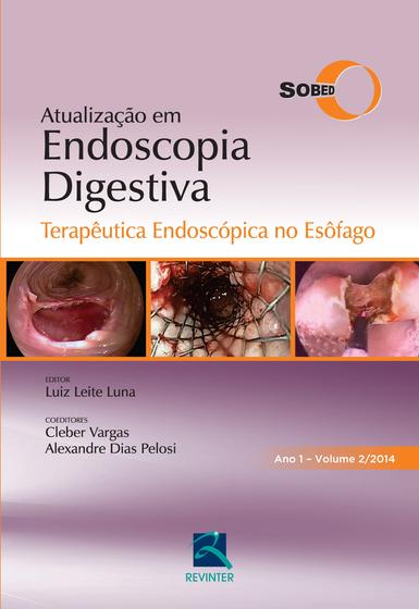 Imagem de Livro - SOBED Atualização em Endoscopia Digestiva - Volume 2