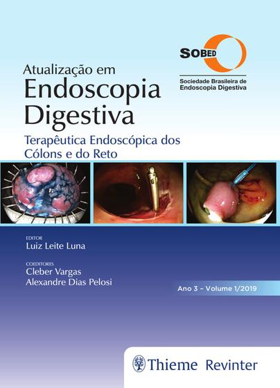 Imagem de Livro - SOBED Atualização em Endoscopia Digestiva