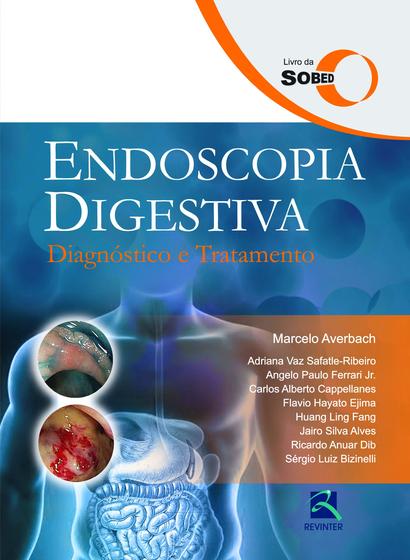 Imagem de Livro - SOBED Endoscopia Digestiva