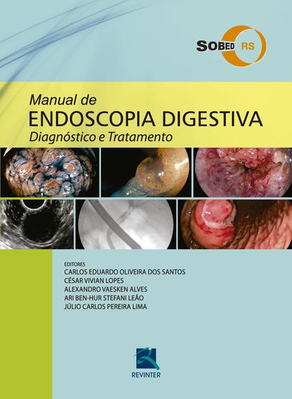 Imagem de Livro - SOBED Manual de Endoscopia Digestiva