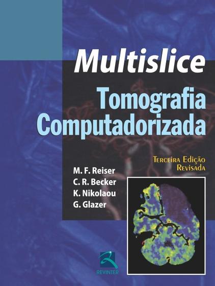 Imagem de Livro - Tomografia Computadorizada Multislice