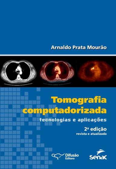 Imagem de Livro - Tomografia computadorizada