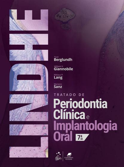 Imagem de Livro - Tratado de Periodontia Clinica e Implantologia Oral