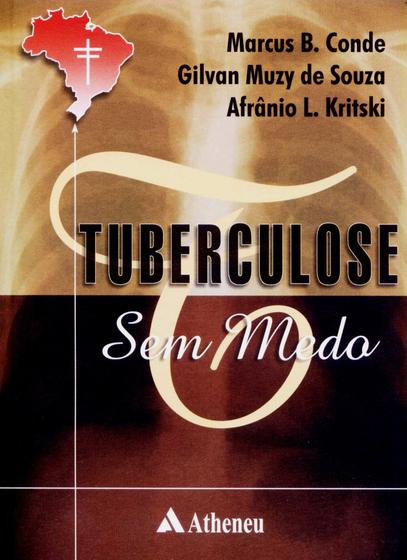 Imagem de Livro - Tuberculose sem medo