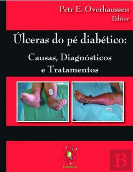 Imagem de Livro Úlceras Pé Diabético Causas Diagnósticos Tratamentos