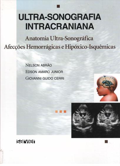 Imagem de Livro - Ultra-sonografia intracraniana