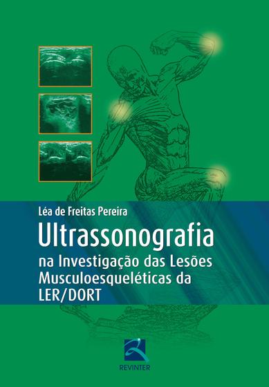 Imagem de Livro - Ultrassonografia na Investigação das Lesões Musculoesqueléticas LER/DORT