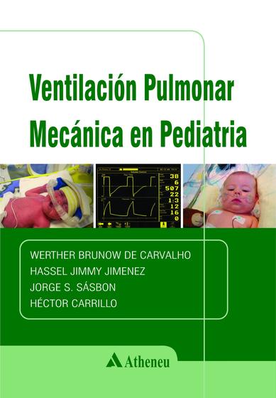 Imagem de Livro - Ventilación Pulmonar Mecánica En Pediatría