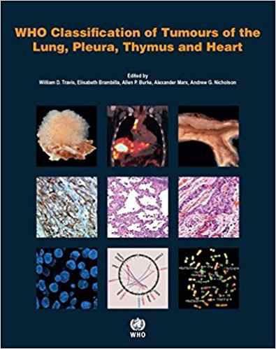 Imagem de Livro Who Classification Of Tumours Of The Lung, Pleura, Thymus An - World Health Organization