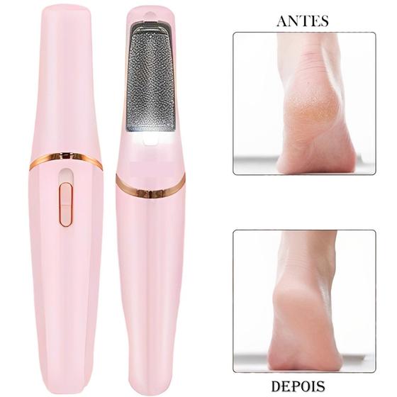 Lixa De Pé Elétrica Wireless Sem Fio Pedicure Tira Calo Pele Morta ...