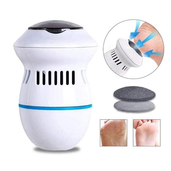 Imagem de Lixador De Pé Elétrico Lixa Elimina Calo Portátil Usb Pilha 110/220 - Callus Remover - JC