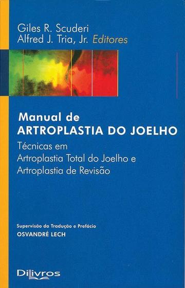 Imagem de Manual de Artroplastia do Joelho - Técnicas em Artroplastia Total do Joelho e Artroplastia de Revisã - DI LIVROS