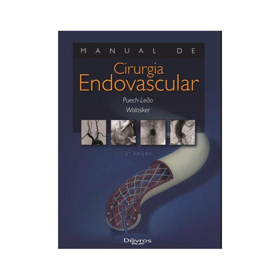 Imagem de Manual de cirurgia endovascular - Di Livros Editora Ltda