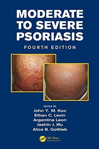 Imagem de Mild to moderate and moderate to severe psoriasis set - INFORMA HEALTH CARE 