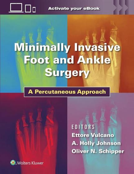 Imagem de Minimally Invasive Foot and Ankle Surgery - Lippincott/wolters Kluwer Health 2024