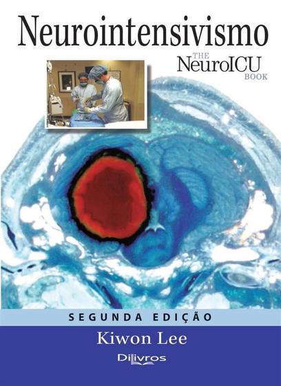 Imagem de Neurointensivismo - Neuro ICU BOOK