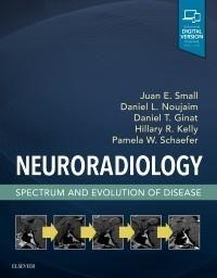 Imagem de Neuroradiology - ELSEVIER (IMPORT)
