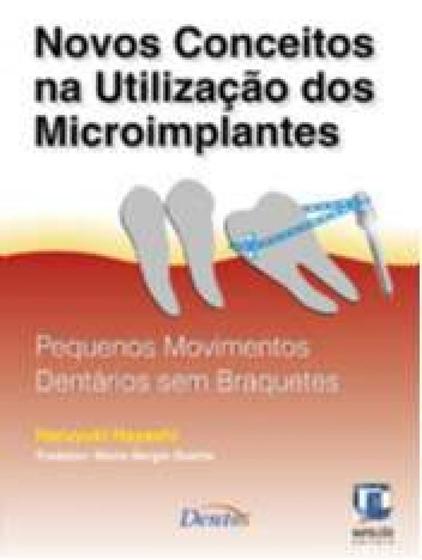 Imagem de Novos conceitos utilizacao microimplantes