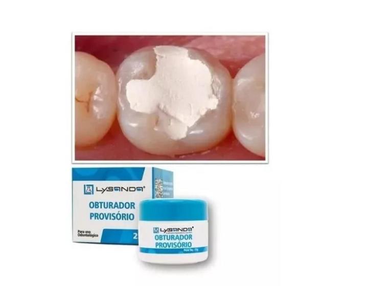 Imagem de Obturador Dentista Provisório 25g Lysanda Tampa