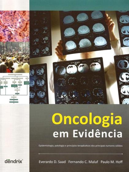 Imagem de Oncologia Em Evidência - Epidemiologia, Patologia e Princípios Terapêuticos - Dendrix
