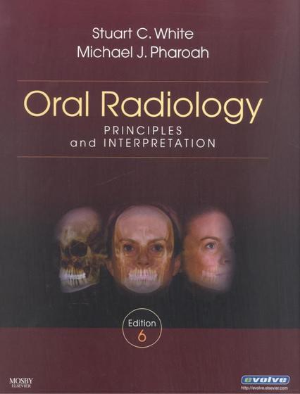 Oral radiology - principles and interpretation - 6th ed - Livros de ...